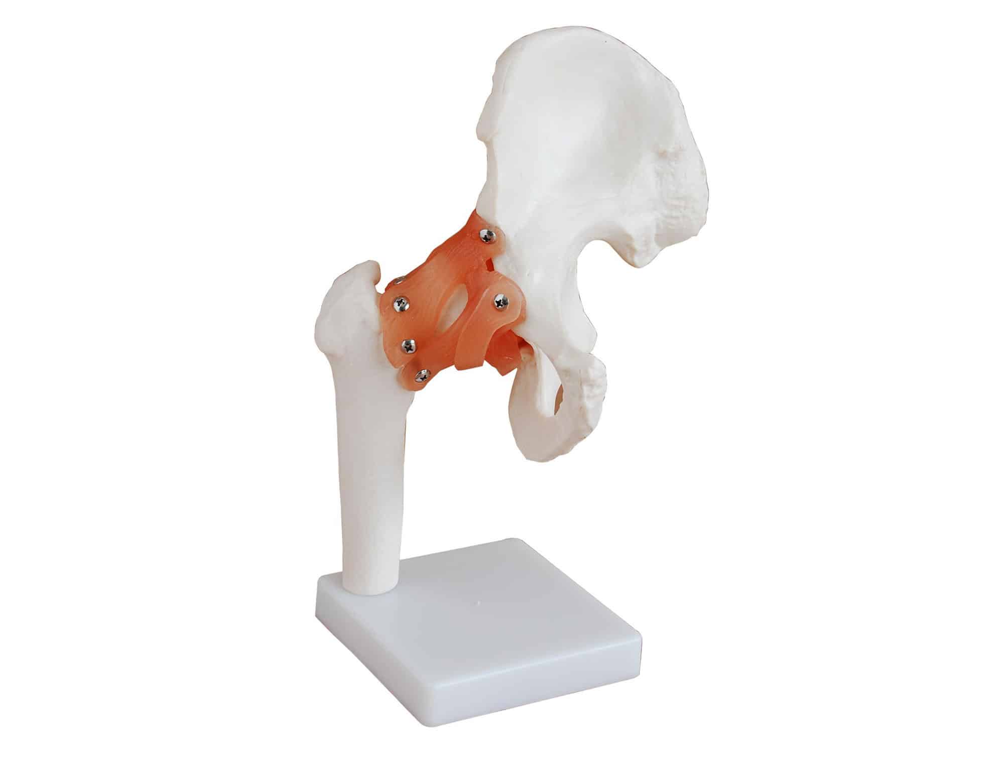 Bassin et hanche -Anatomie et pathologie