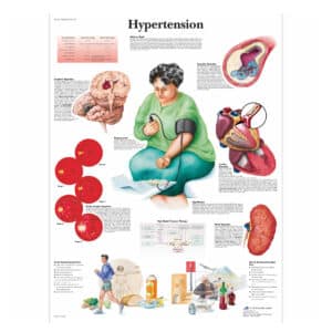 L’hypertension