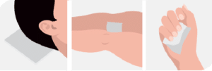 Utilisation de la Plaque Sacrum pour répartition de la pression