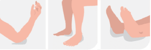 Utilisation de la Plaque Sacrum pour répartition de la pression (1)