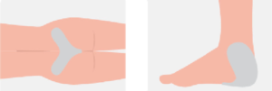 Utilisation de la Plaque Sacrum pour répartition de la pression (3)