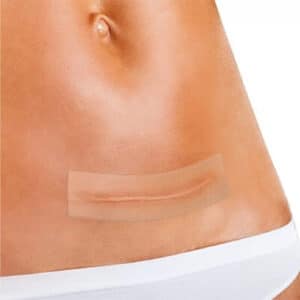 Plaque de silicone
