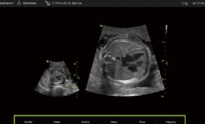 Echographe Vinno A3-Interface