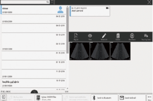 Echographe Vinno A3-Interface