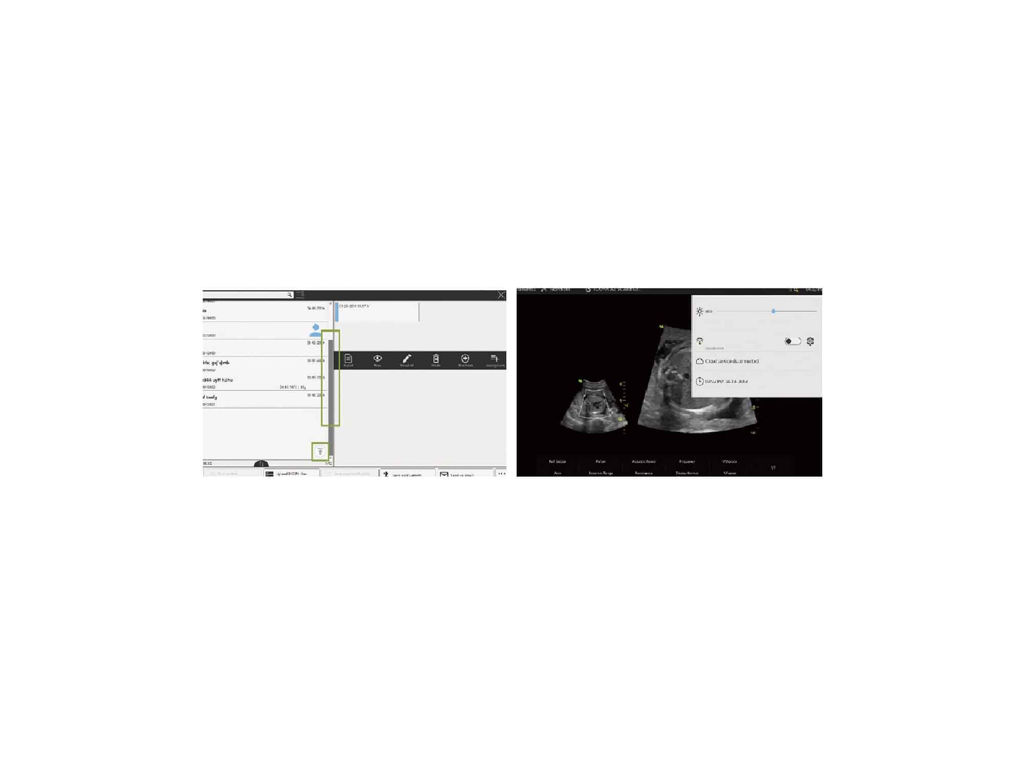 Echographe portable Vinno A3