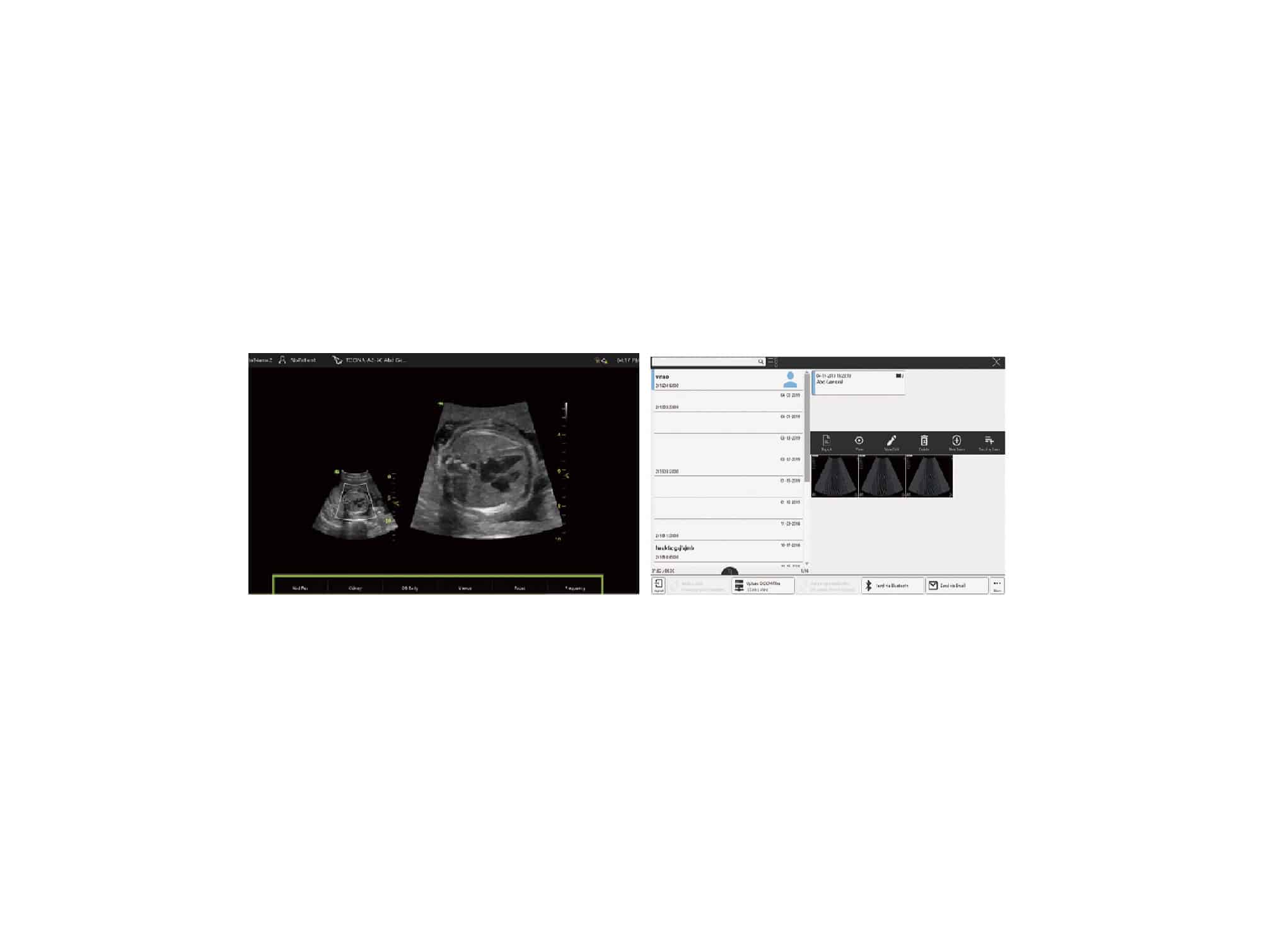 Echographe portable Vinno A3
