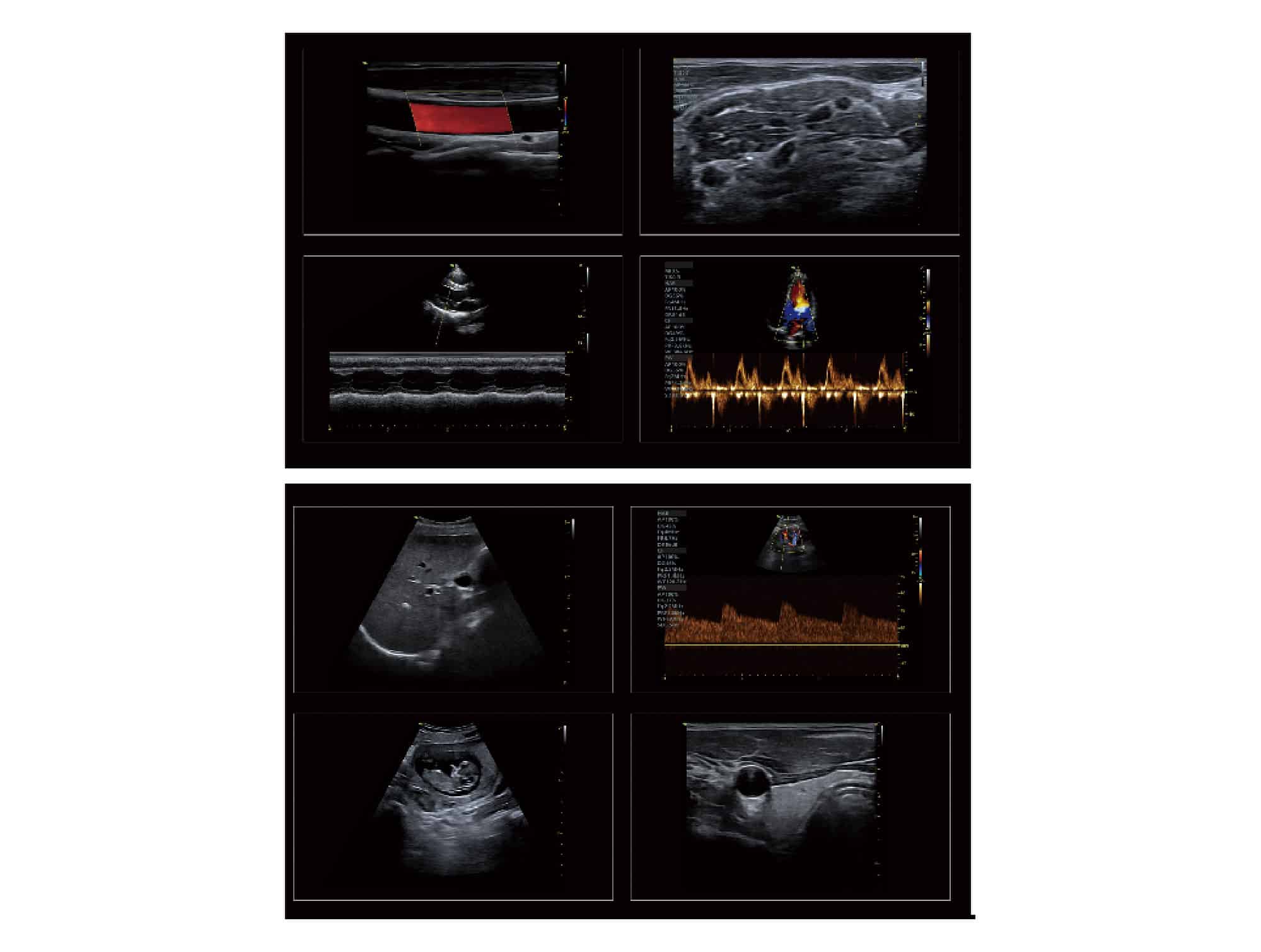 Echographe portable Vinno A3