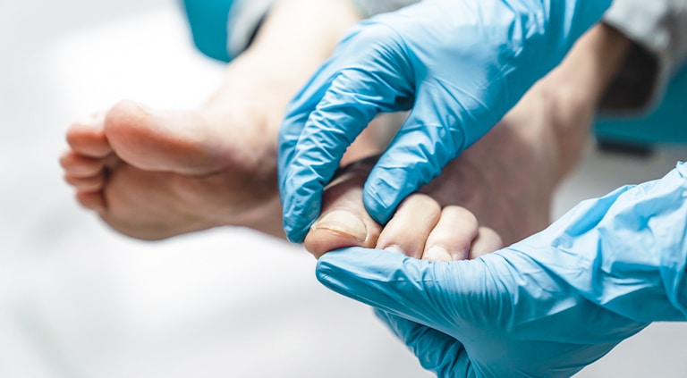 Stepcare