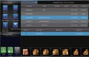 Echographe Vinno X35-Examen