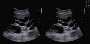 Echographe Vinno X35-Diagnostic