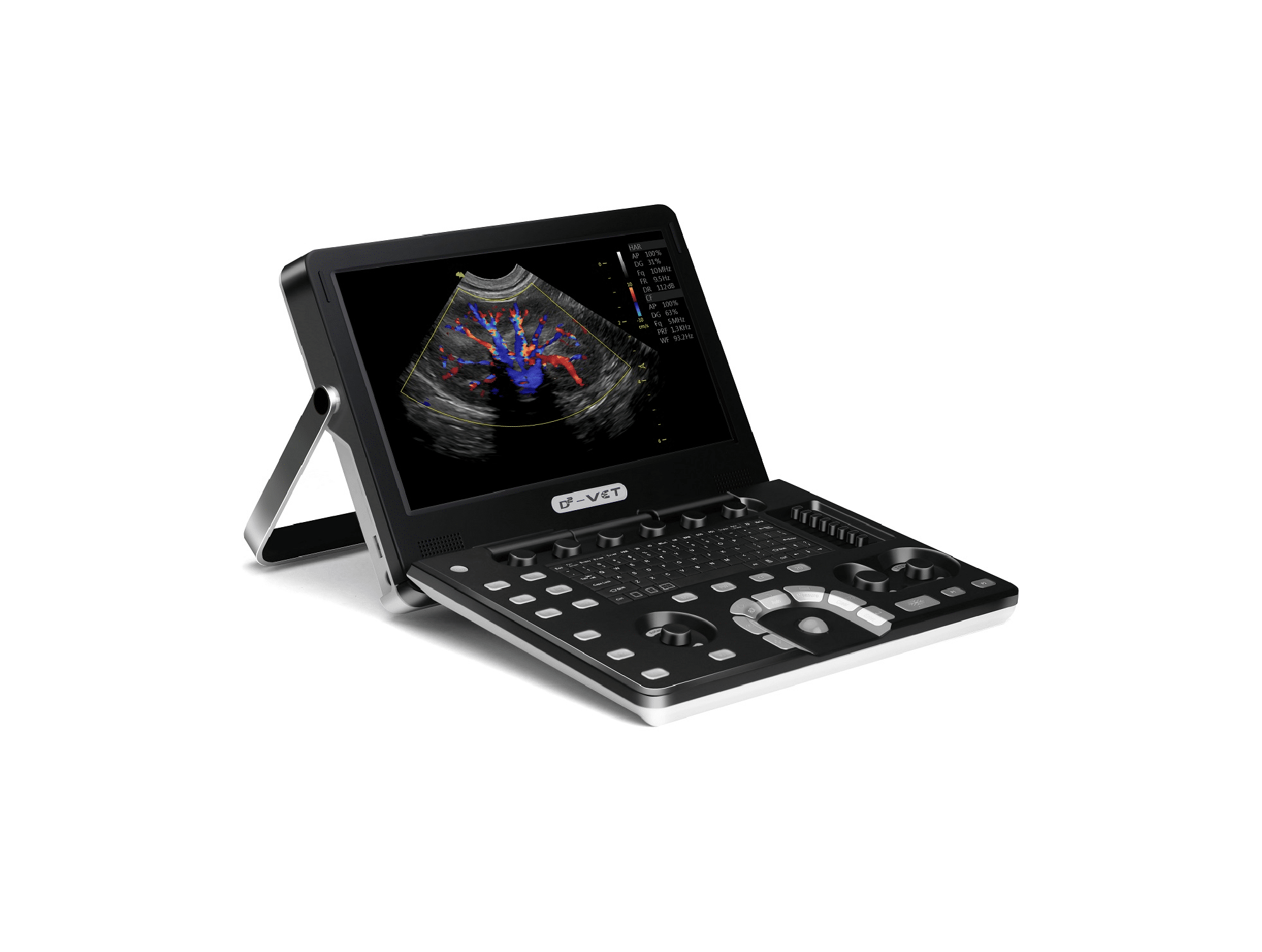 Echographe Vinno D2VET