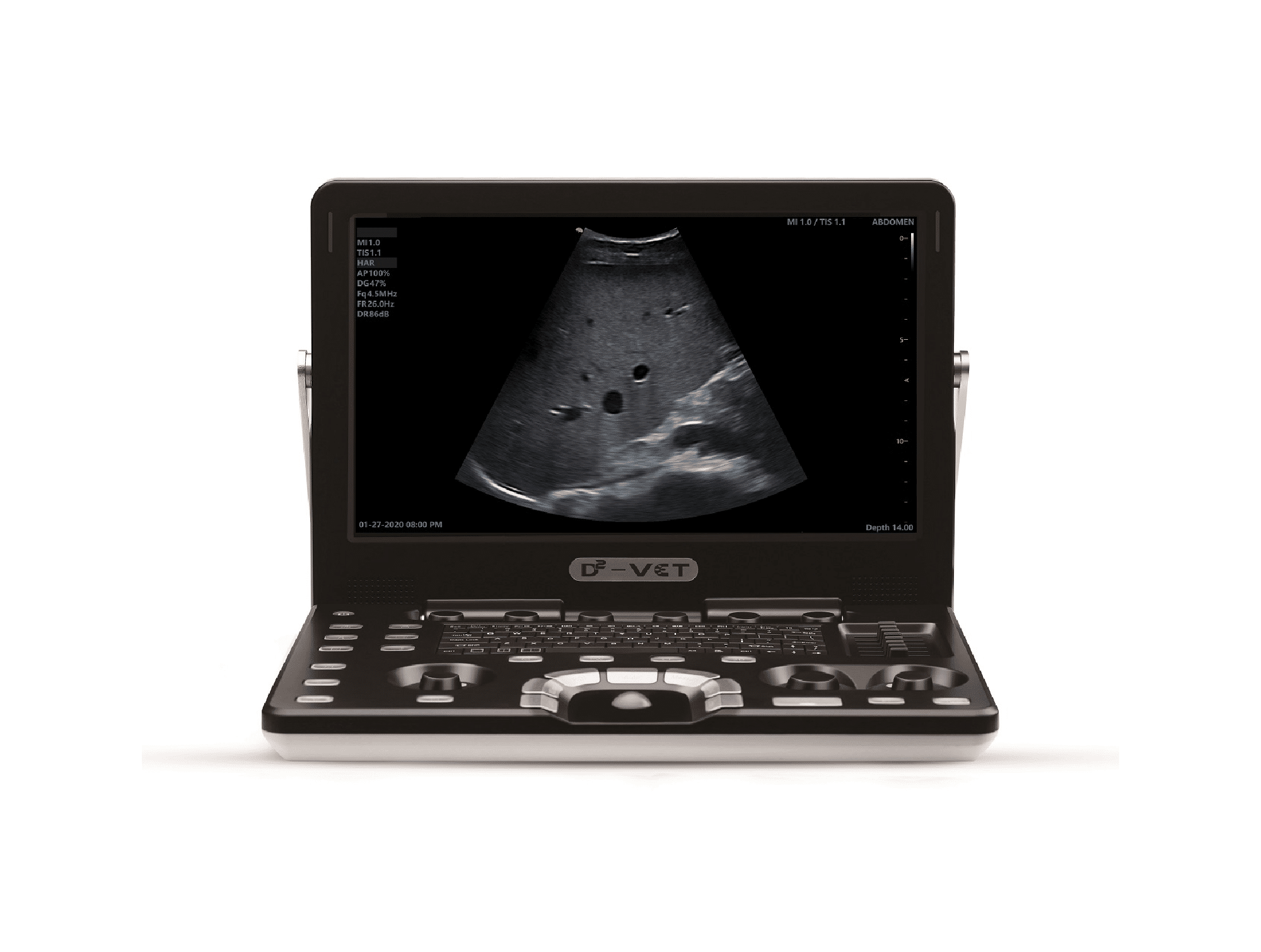 Echographe Vinno D2VET Portable en Couleur